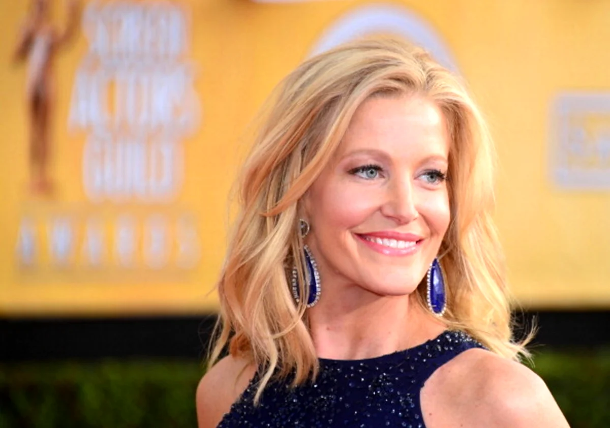 Anna Gunn