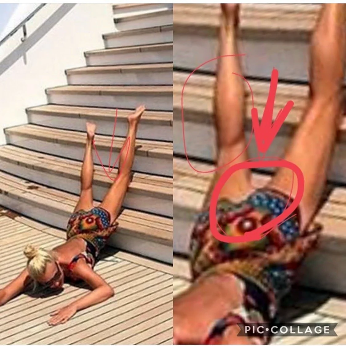 Ноги Собчак без фотошопа