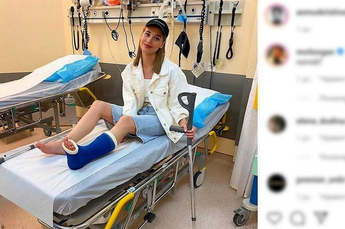 Девушке загипсовали ножку