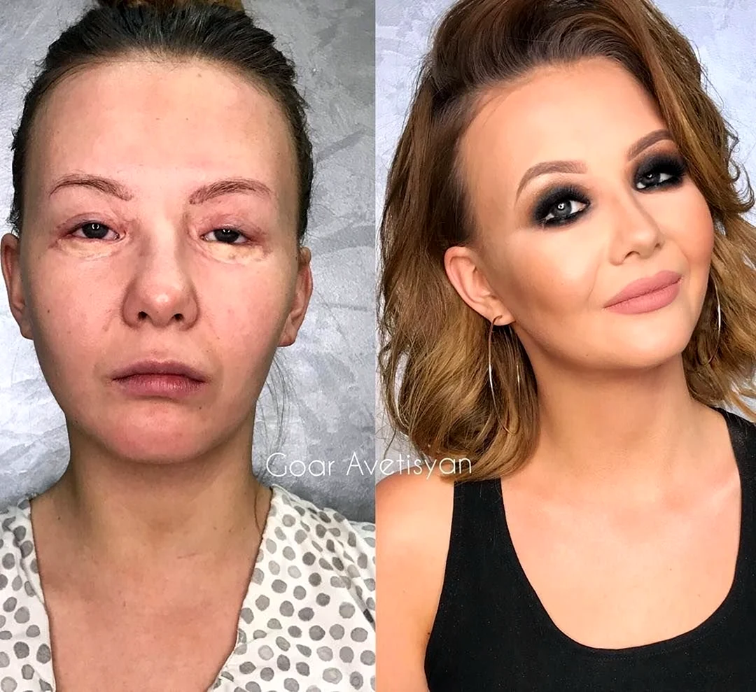 Гоар Аветисян Преображения