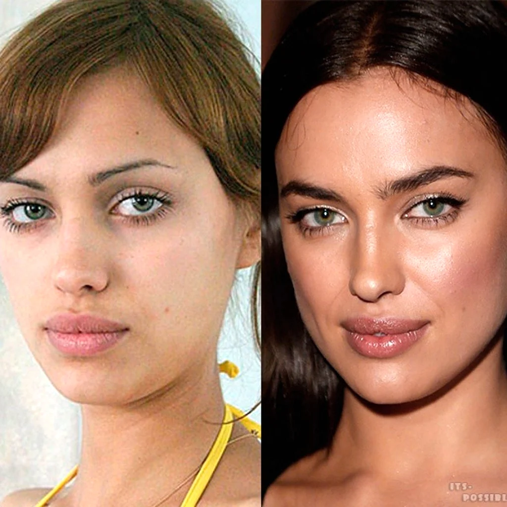 Ирина Шейк хейлопластика