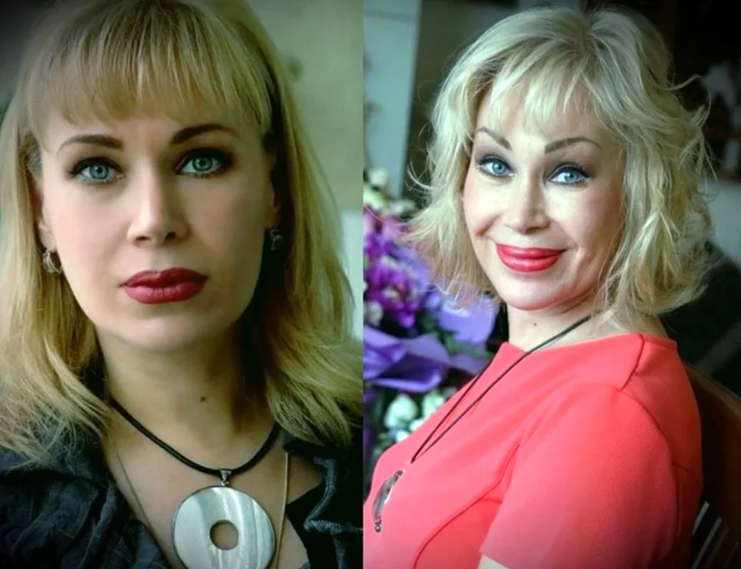 Ольга Спиркина до пластики