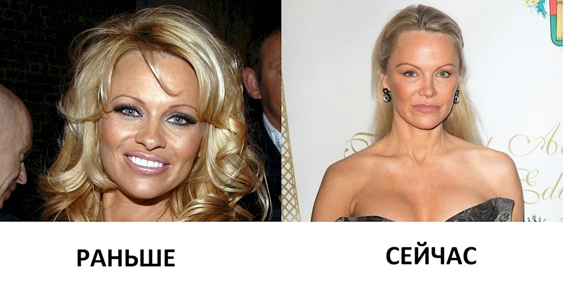 Памела Андерсон в молодости и сейчас