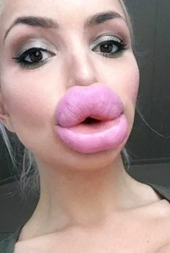 Силиконовые губы